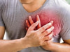 Pathologie cardiovasculaire
